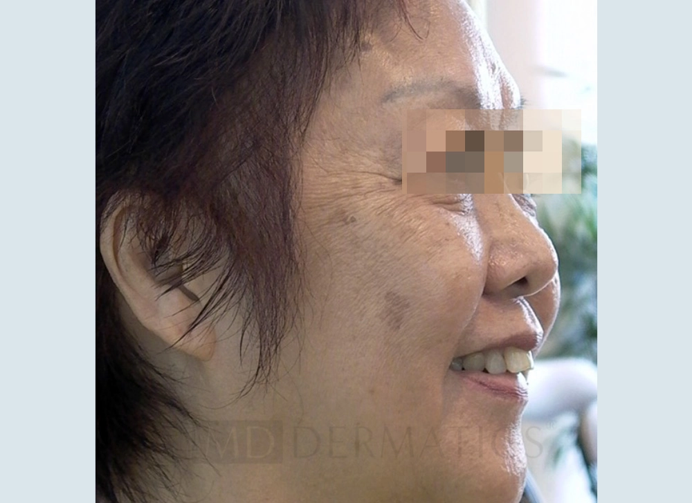 Image Before