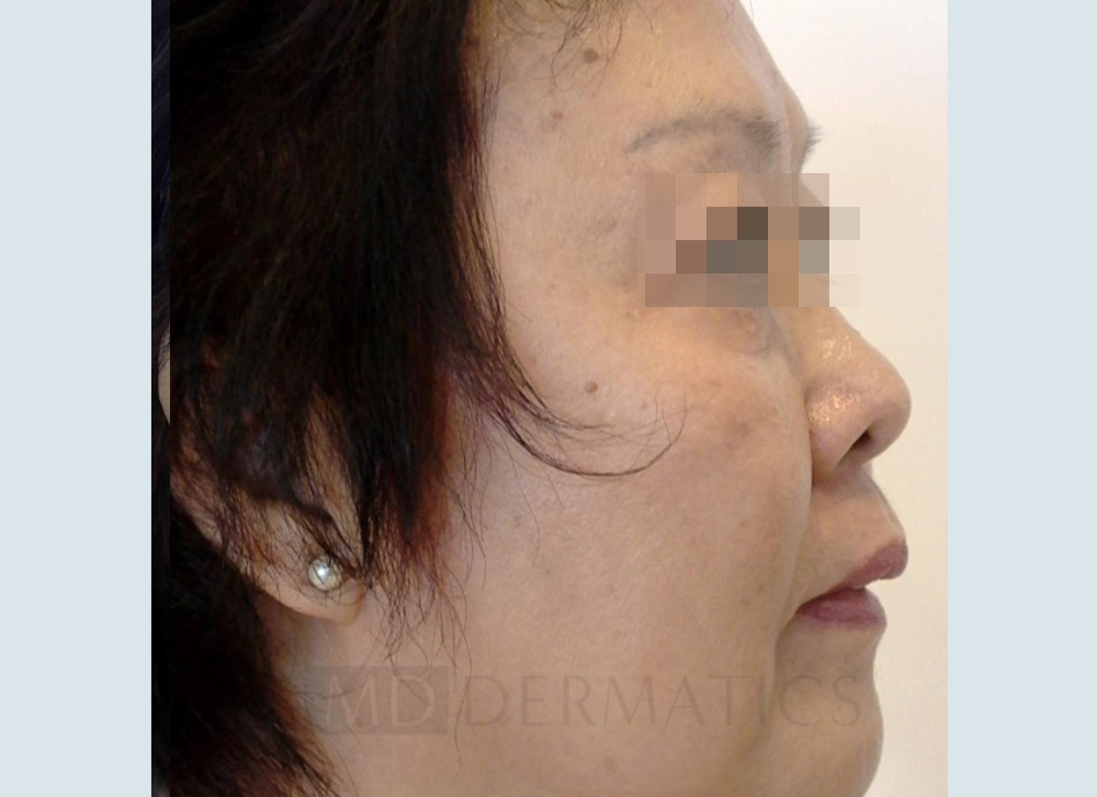 Image After