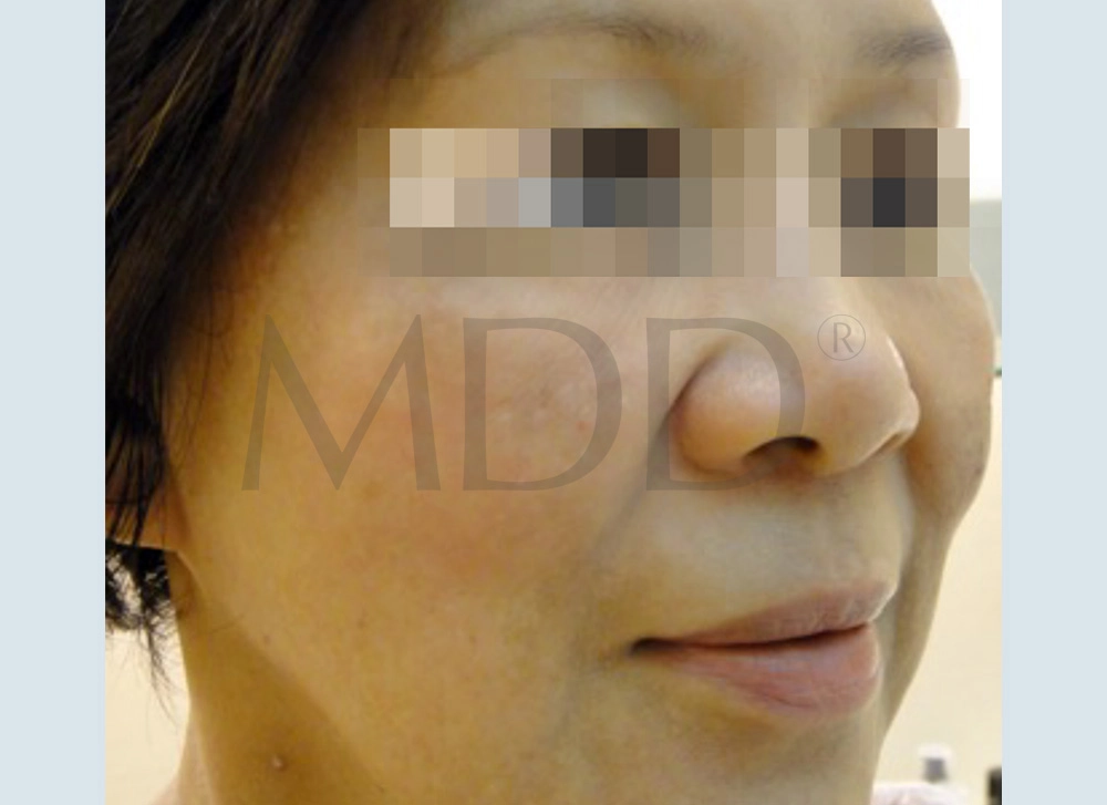 Image After